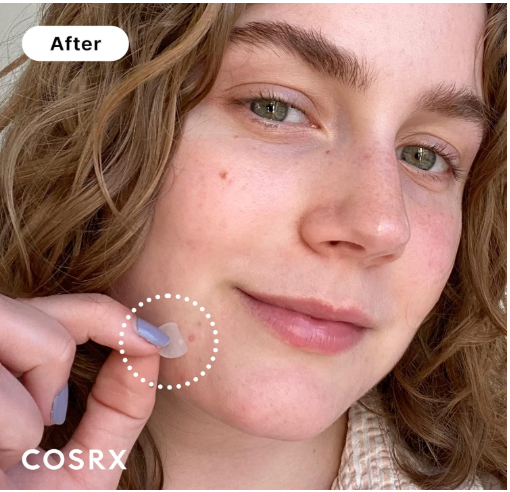 Load image into Gallery viewer, COSRX Acne Pimple Patch (96) Absorbing Hydrocolloid- - Bint Adem Portal #
