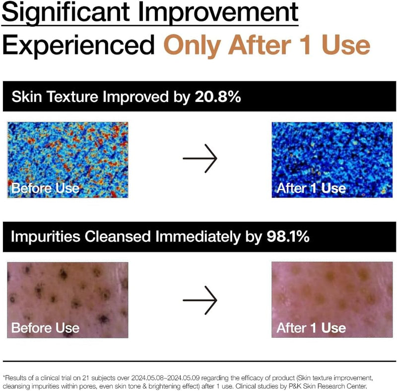 Load image into Gallery viewer, ANUA Rice Enzyme Brightening Cleansing Powder 40g - Bint Adem Portal #
