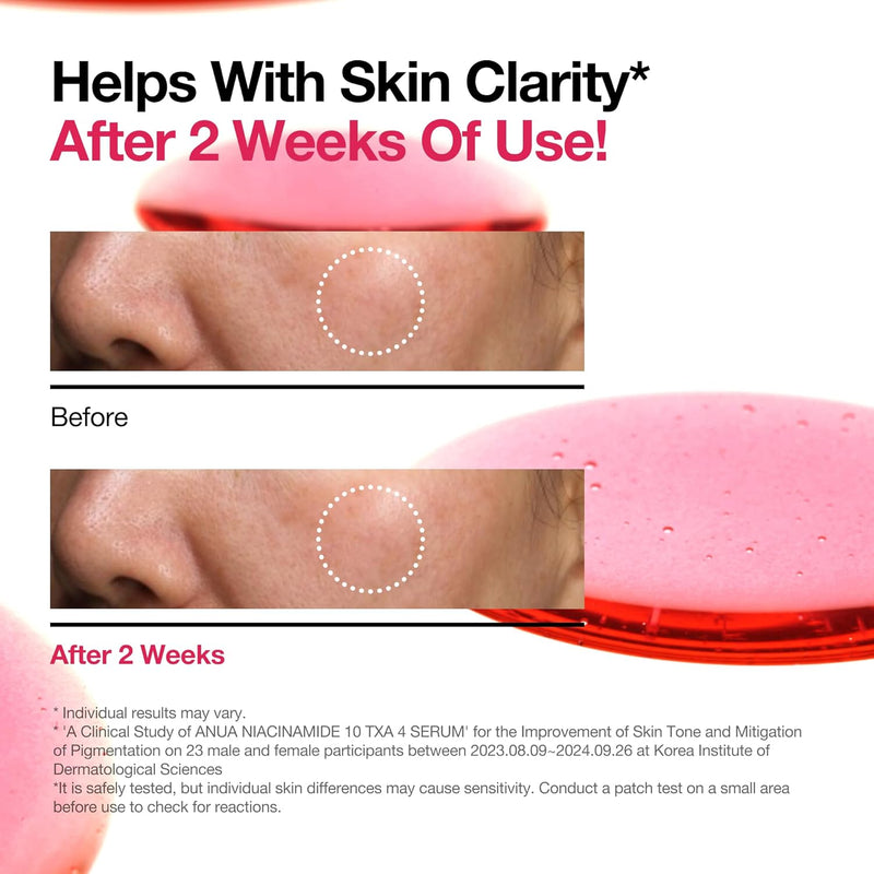 Load image into Gallery viewer, ANUA 10% Niacinamide + 4% TXA Serum, Ceramide, Hyaluronic Acid 30ml - Bint Adem Portal #
