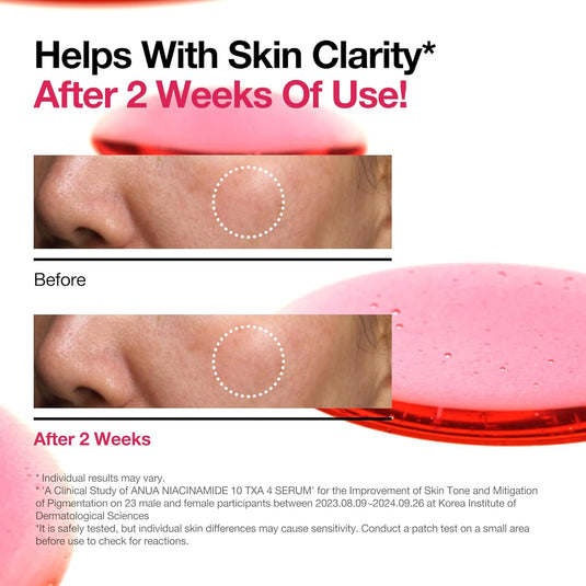 ANUA 10% Niacinamide + 4% TXA Serum, Ceramide, Hyaluronic Acid 30ml